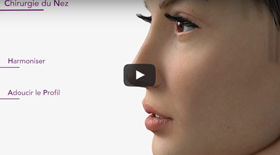 Rhinoplastie / chirurgie du nez