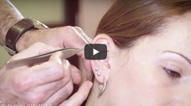 Chirurgie des oreilles