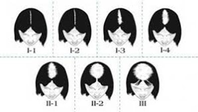 Classification de LUDWIG